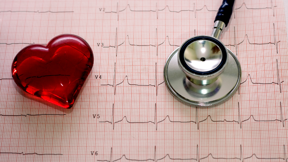 Healthcare career, Electro Cardiology Technician name image